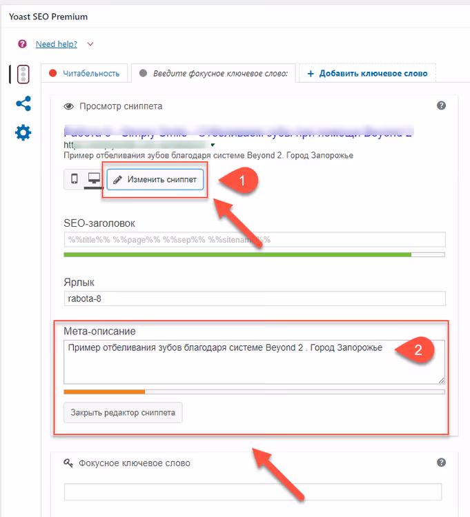 Metabox estratto nell'editor di WordPress